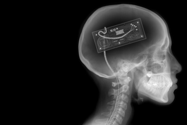 Gamepad dans le crâne sur la radiographie. Squelette sur fond noir et blanc