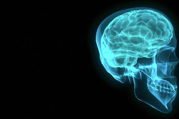 Radiografia del cervello nella proiezione laterale