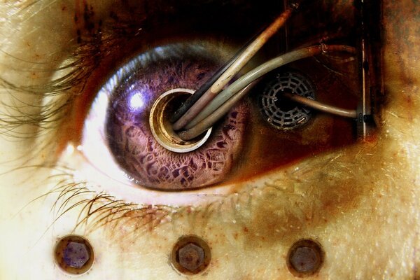 Imagen biomecánica del ojo con cables