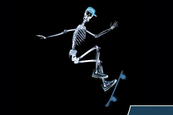 X-ray of a skeleton on a skateboard in motion