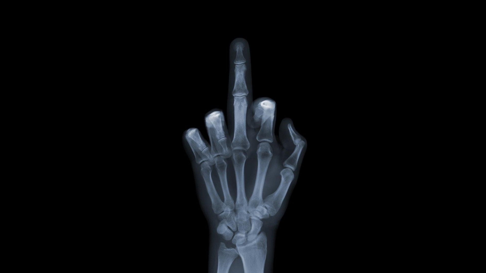 x-rays hand fuck you factor yu picture bone wallpaper