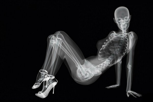 Sexy x-ray fille en talons