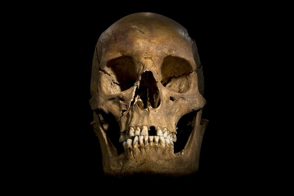 A human skull without one tooth