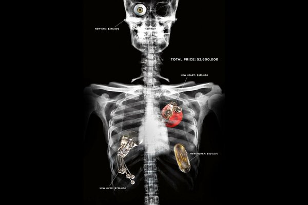 X-ray of a human skillet with a description